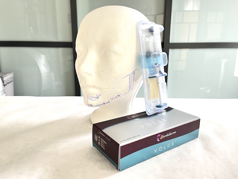 Juvederm Volux for chin sculpting Juvederm Volux syringe used for chin contouring filler in Toronto