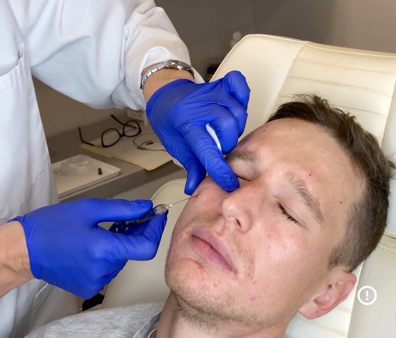 Best Under Eye Filler Specialist Toronto – MedVSPA Yorkville Experienced injector performing under eye filler at MedVSPA in Yorkville Toronto