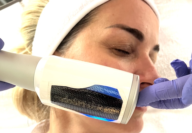 Endosphères Treatment Zones for the Face Cheekbone zone treated by Endosphères Facial in Toronto